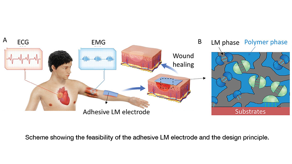 Facilitating skin wound healing and health monitoring via advanced epidermal bioelectronics