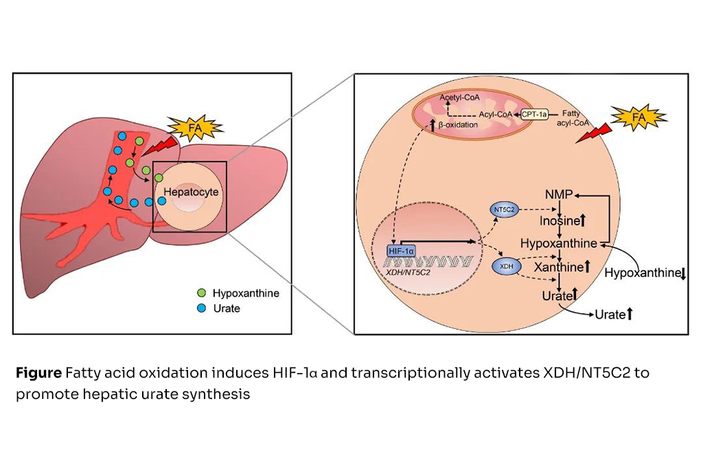 Professor YIN Huiyong’s team has made a significant breakthrough in understanding a mechanism linking hyperuricemia to hypertriglyceridemia