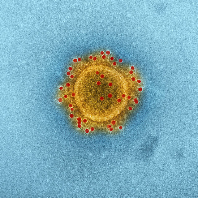 Infectious Diseases & Immunity