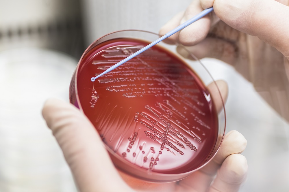 RGC Theme-based Research Scheme, CityU